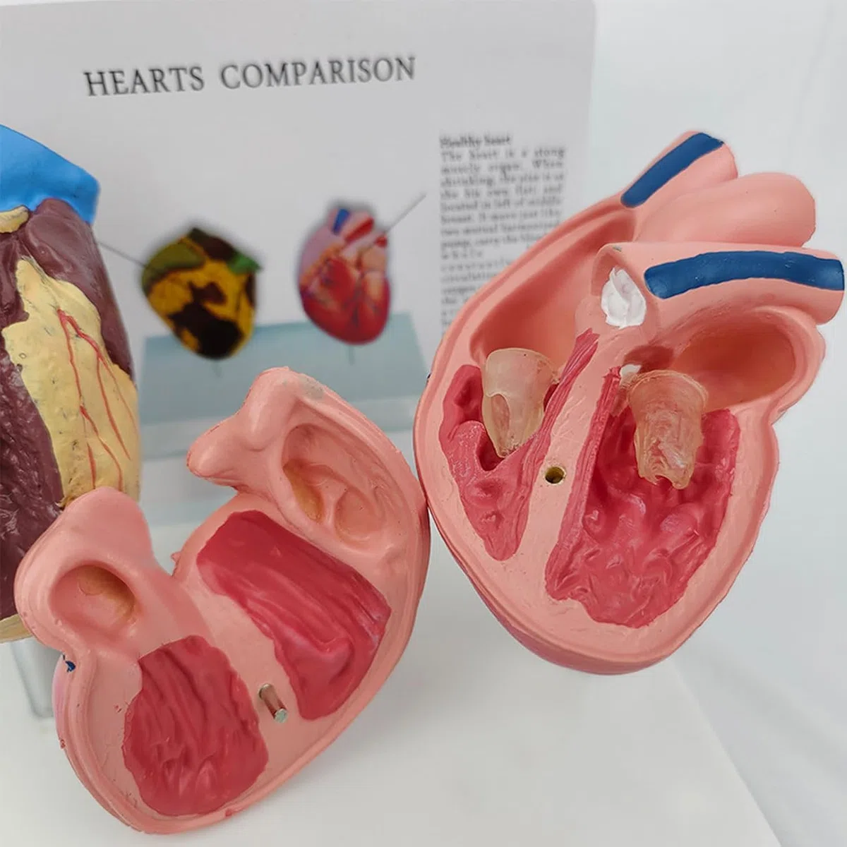 Model anatomiczny patologicznego serca, model porównawczy zdrowego serca i palenia serca, narzędzie do komunikacji lekarza i pacjenta, do prezentacji nauki, nauczania medycznego