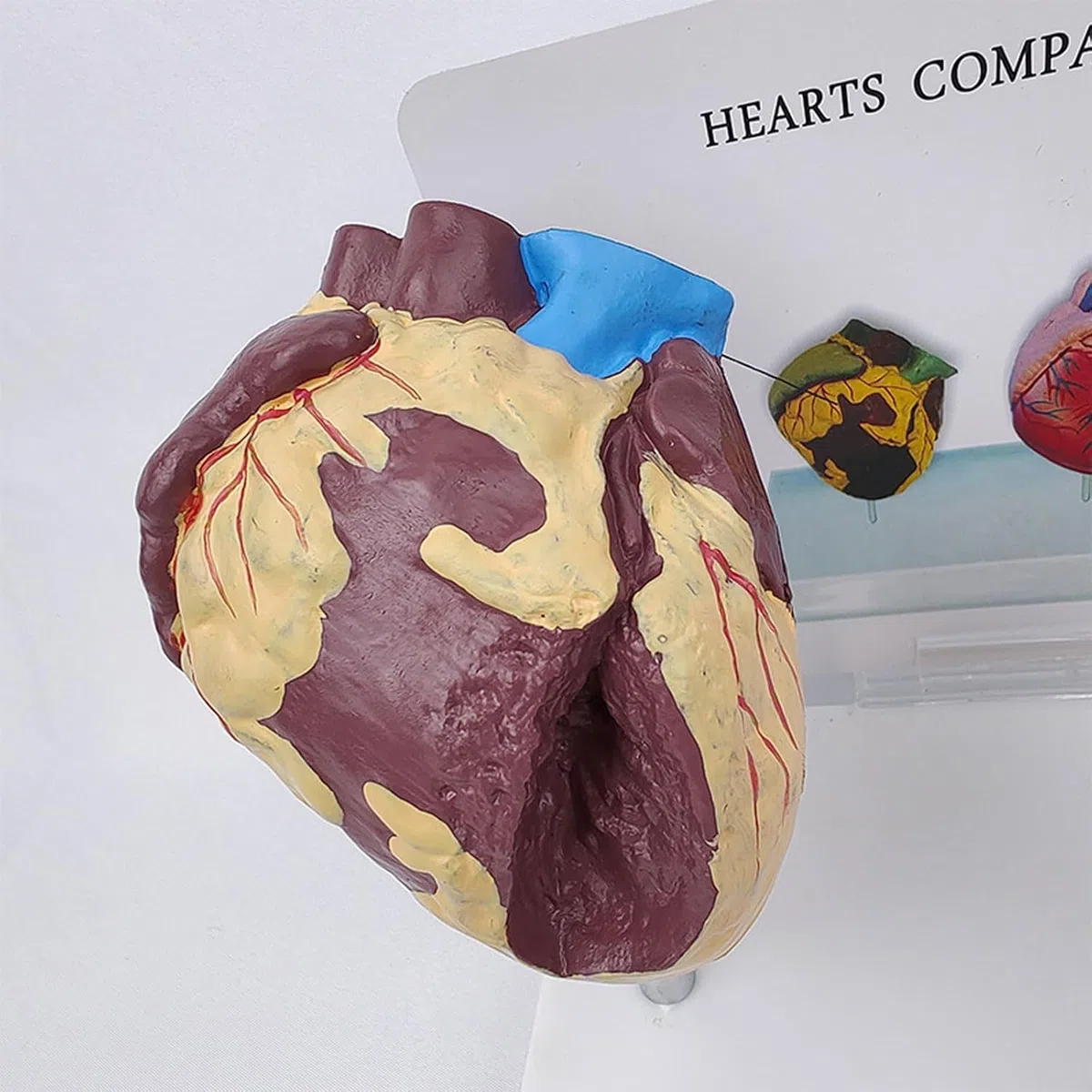 Model anatomiczny patologicznego serca, model porównawczy zdrowego serca i palenia serca, narzędzie do komunikacji lekarza i pacjenta, do prezentacji nauki, nauczania medycznego